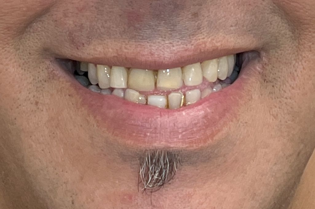 Before