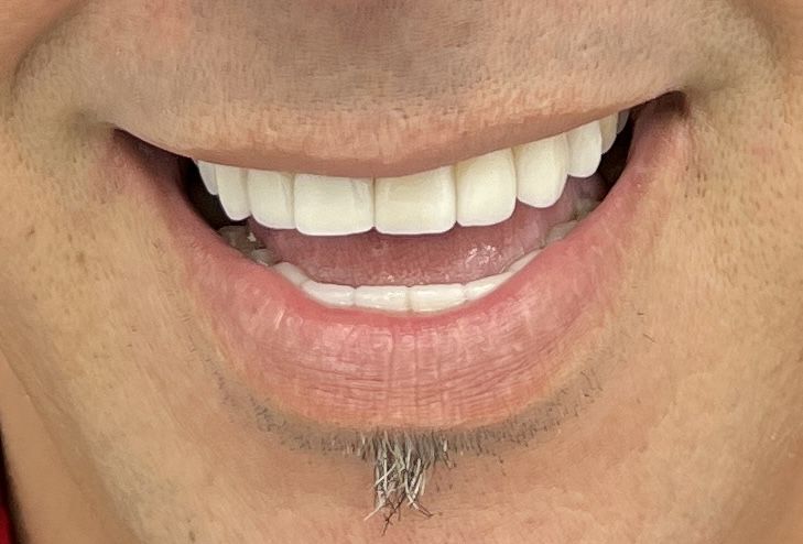 After