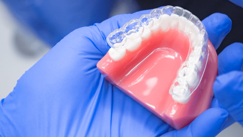 Dental professional holding a clear aligner over a teeth model, illustrating orthodontic treatment.